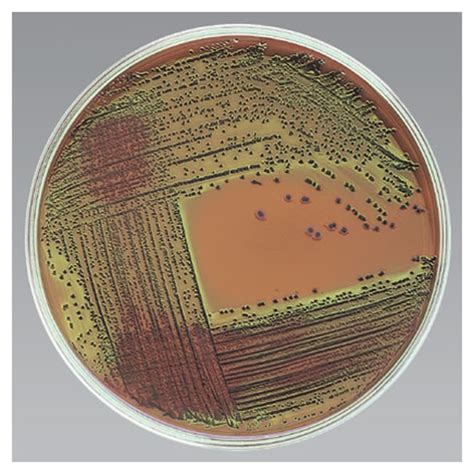 3.13: Levine EMB Agar .